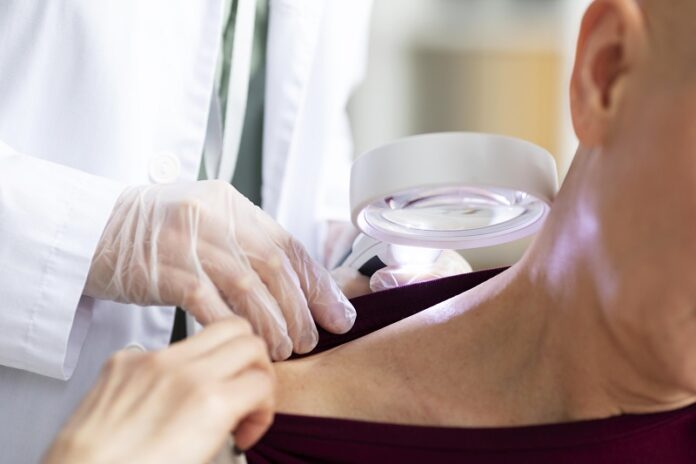 doctor doing check patient with skin cancer doctor doing check patient with skin cancer